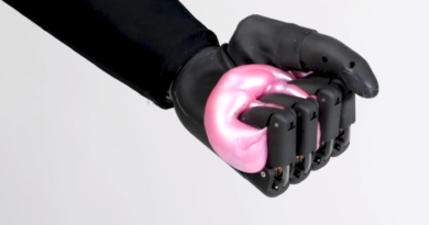 bionic hand prosthesis