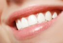 Pretty Smiles: 6 Terrific Benefits of Straight Teeth