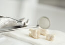 8 Signs It’s Time to Have a Tooth Pulled